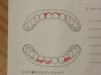 『5nenhamigaki10』の画像